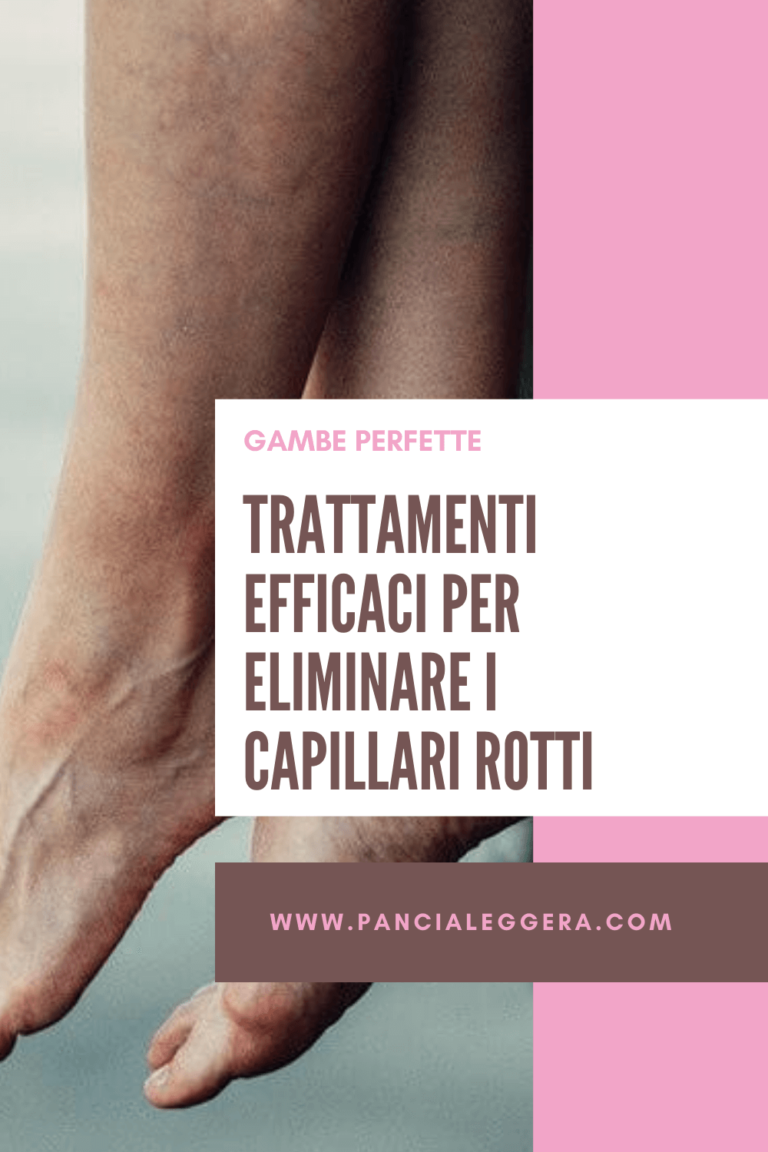 Capillari Rotti Sulle Gambe Cause E Trattamenti Efficaci Pancia Leggera