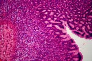 ecosistema-gastrointestinale-pancialeggera
